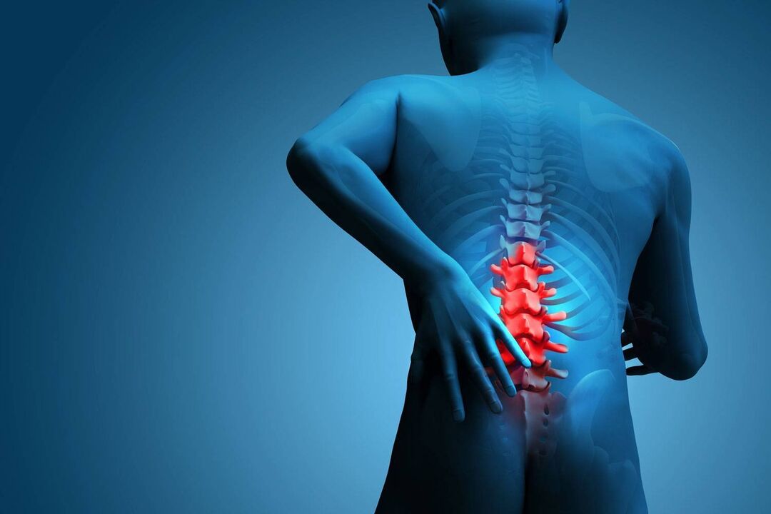 Dolore nell'osteocondrosi lombare
